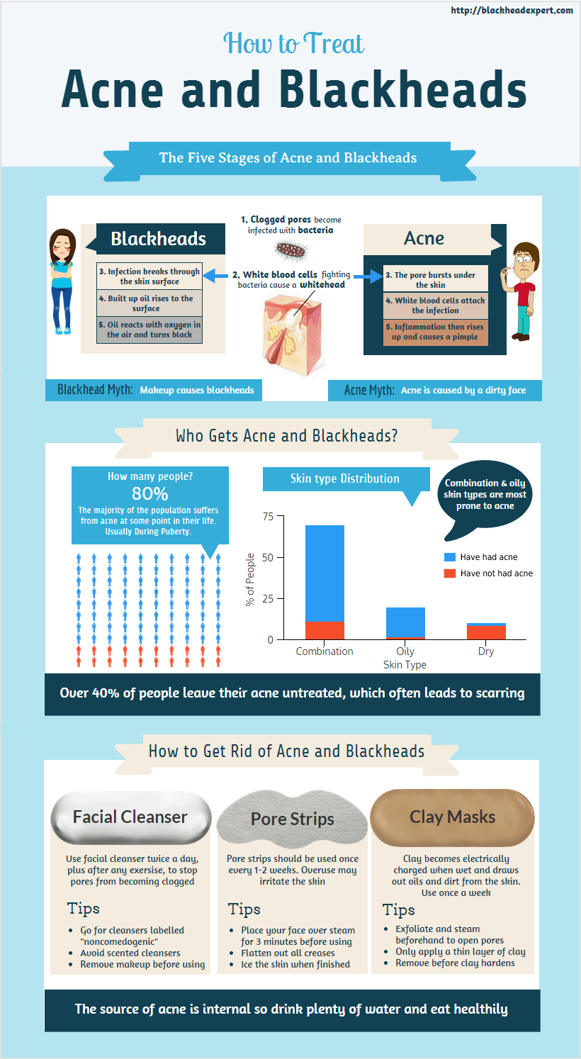 How To Treat Acne And Blackheads : R/Infographics