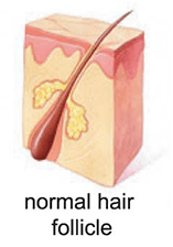 hair follicle